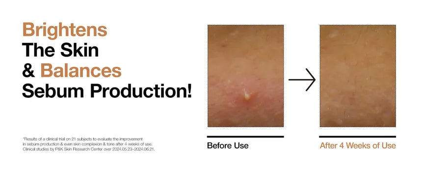 Anua - Tónico Rice 70 Glow Milky Toner